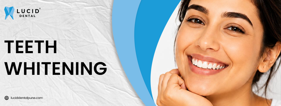 How to Reduce Tooth Sensitivity After Teeth Whitening