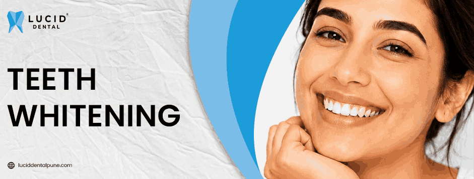 How to Reduce Tooth Sensitivity After Teeth Whitening