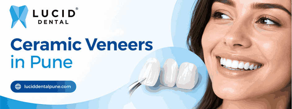 Ceramic veneers in Pune