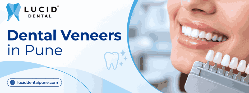 Dental Veneers in Pune